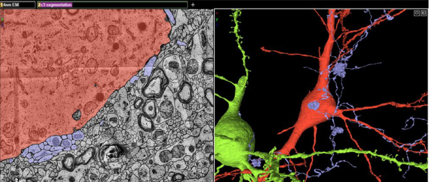 Axón verticilo - Axón en espiral único que produce múltiples floretes y sinapsis en el soma y los ejes dendríticos de las neuronas (Google/Harvard).